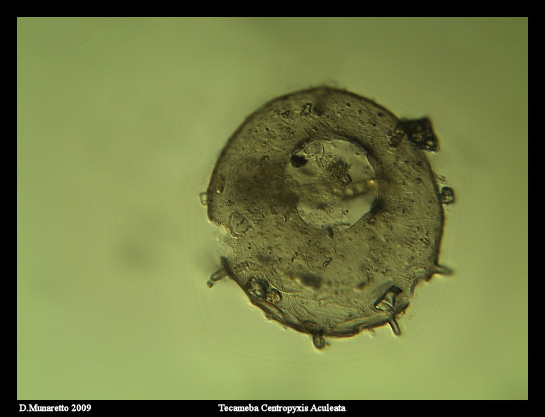 Centropyxis Aculeata